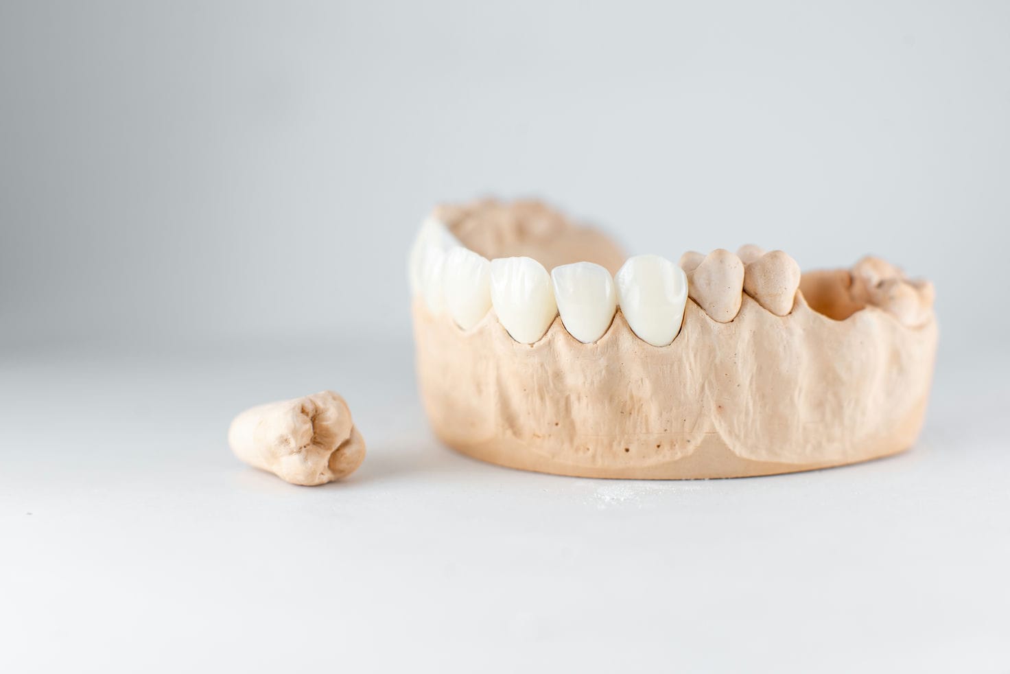 model of artificial jaw and tooth on the white bac 2021 09 01 14 47 45 utc 1 c